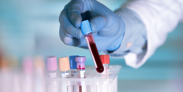 Blood Pregnancy Tests