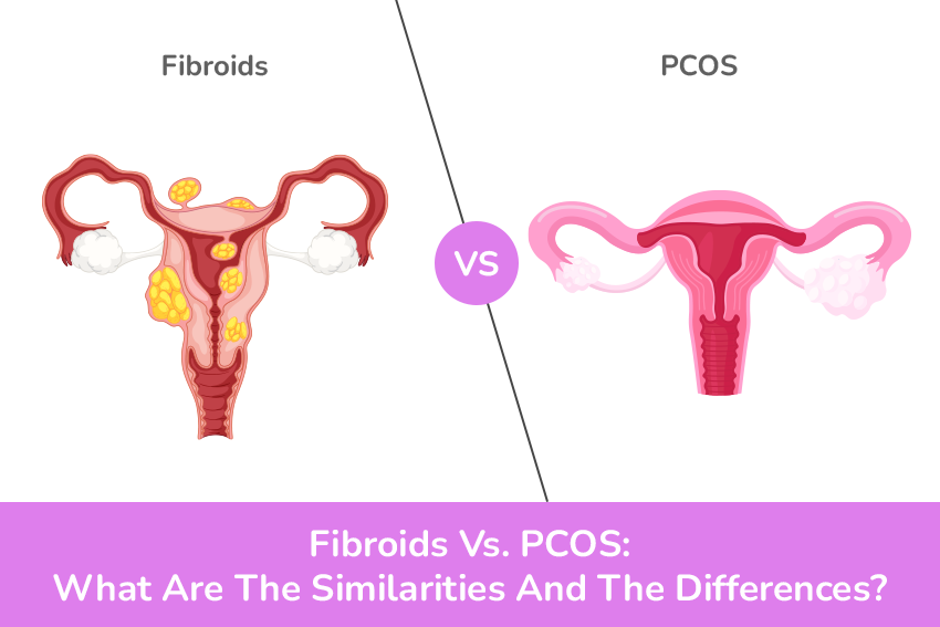 Don'T Miss This: Expert Advice On Fibroids And Healthcare Equality - 0my8h43