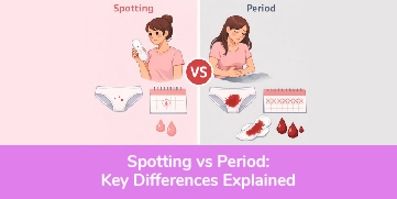 Spotting vs Period: Key Differences Explained
